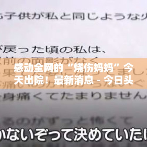 感动全网的“烧伤妈妈”今天出院！最新消息 - 今日头条