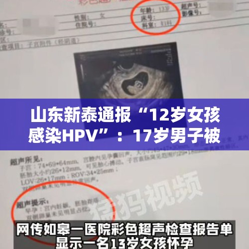 山东新泰通报“12岁女孩感染HPV”：17岁男子被采取刑事强制措施 - 今日头条